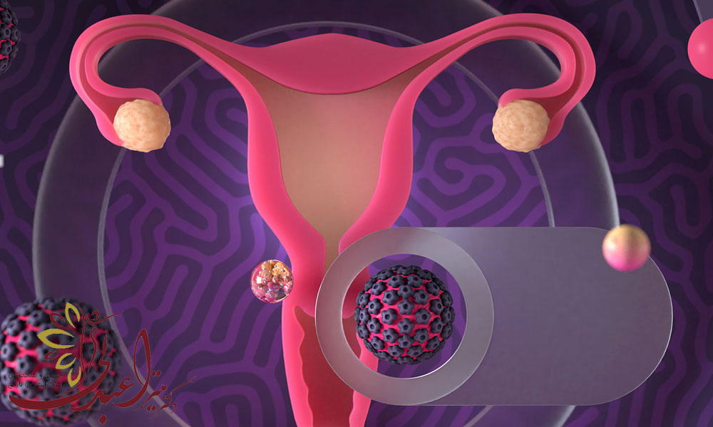درمان عفونت های دستگاه تناسلی در زنان