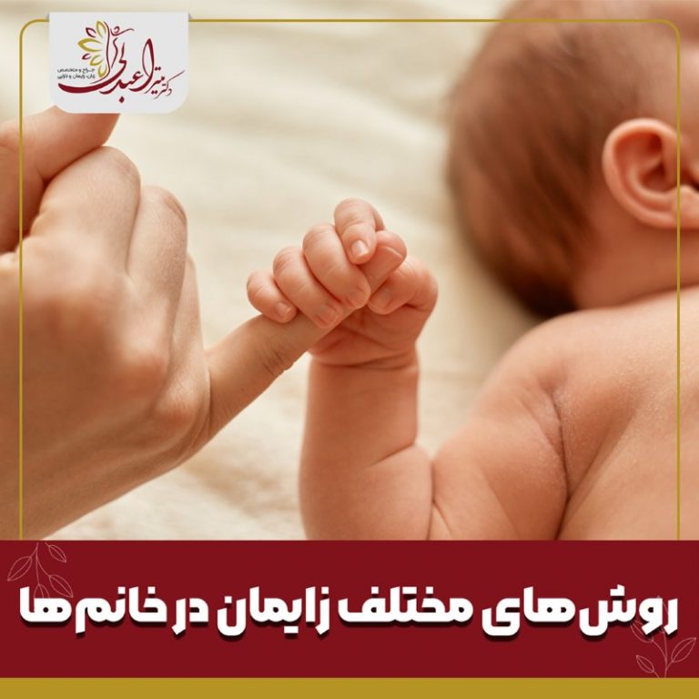 روش های مختلف زایمان