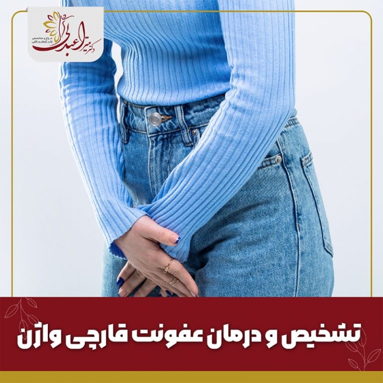 عفونت قارچی واژن