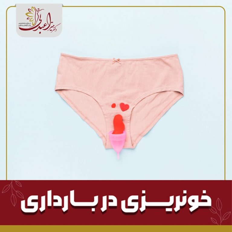 خونریزی در بارداری