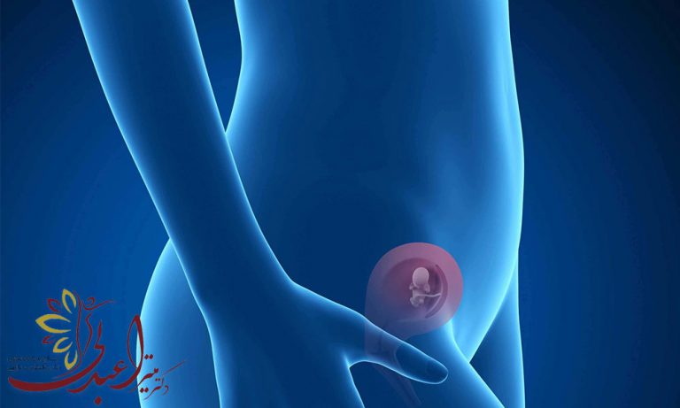 راه های جلوگیری از سقط جنین در سه ماه اول بارداری