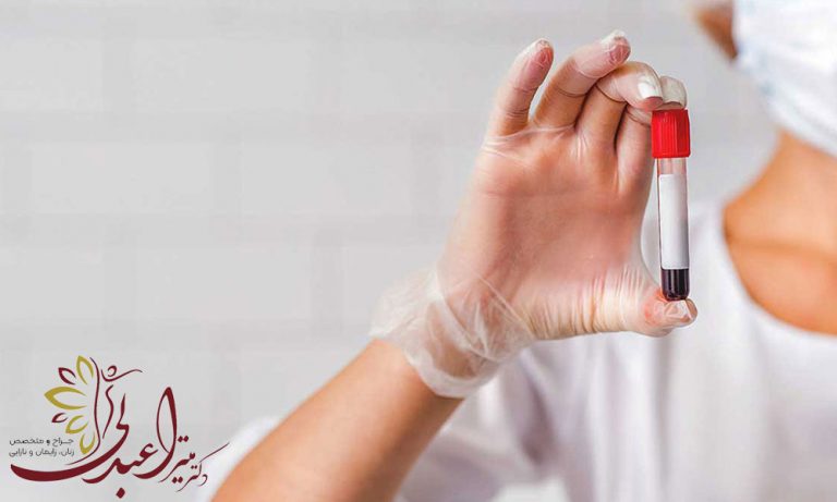 آزمایش عفونت های مقاربتی و آنچه باید بدانید