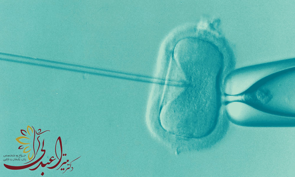 آی وی اف چند بار امکان پذیر است؟