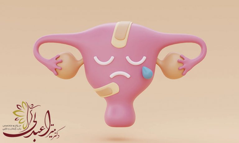 انواع عفونت واژن