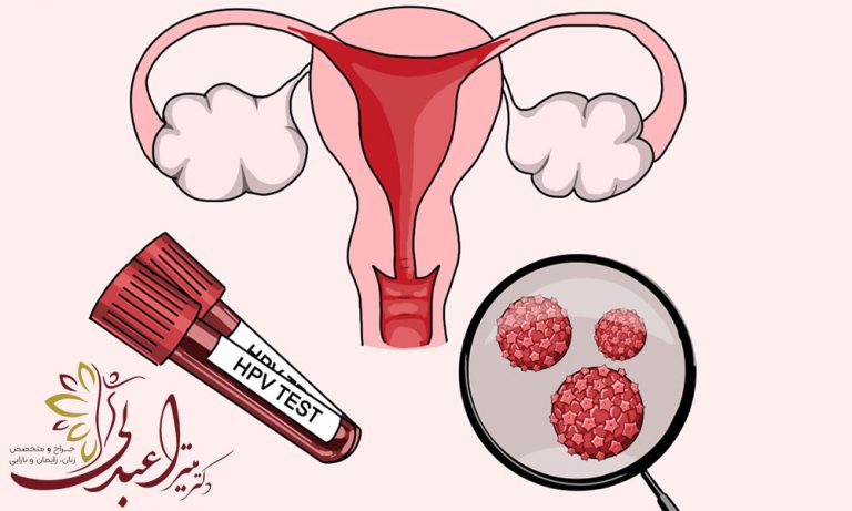 زگیل تناسلی یک تهدید خاموش اما جدی