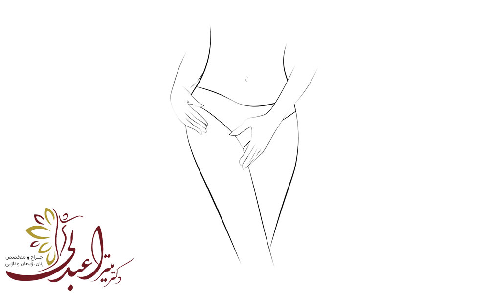 لابیاپلاستی و رضایت جنسی