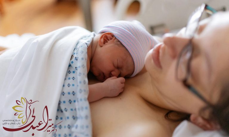 خونریزی بعد از سزارین