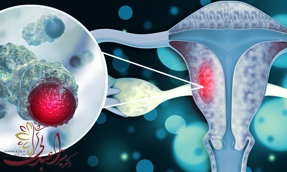 کلپوسکوپی برای HPV