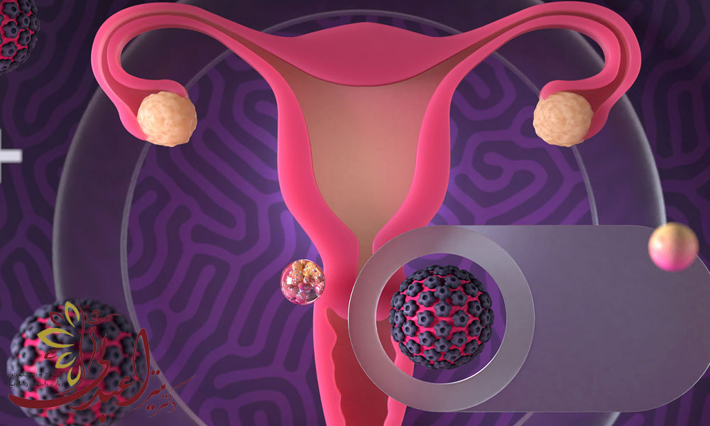 کلپوسکوپی برای HPV