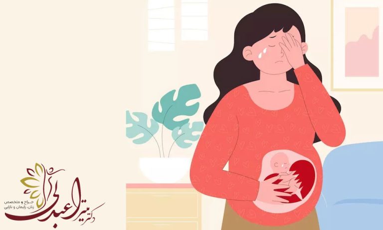 سقط مکرر و درمان