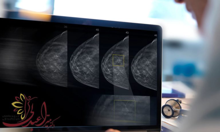 ماموگرافی با چه هدفی انجام می شود