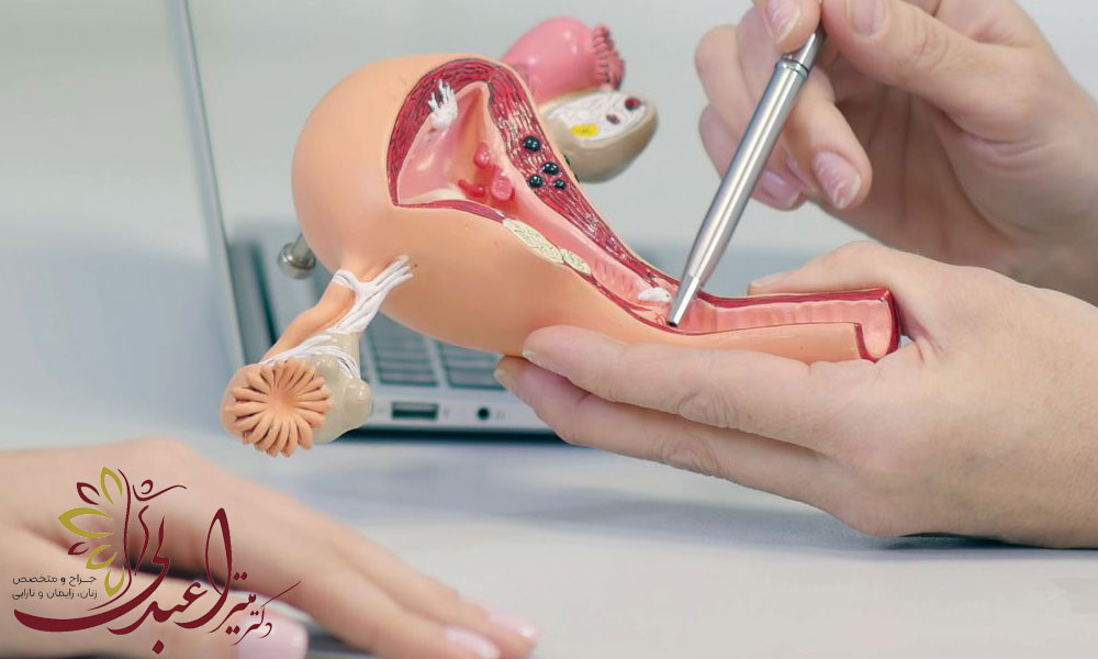 لاپاراسکوپی در درمان مشکلات زنان